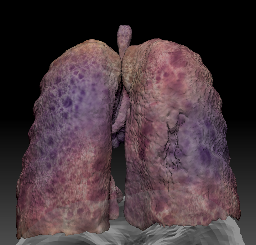 3D models ofThoracic bones